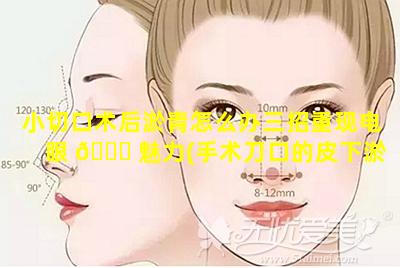 小切口术后淤青怎么办三招重现电眼 🐛 魅力(手术刀口的皮下淤青什么时候可以消下去)